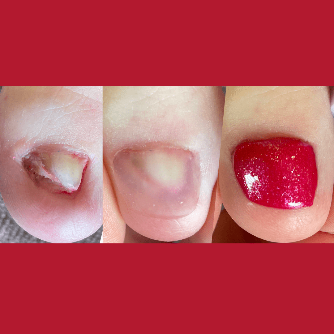 Solutions for Unattractive Nails Lili Salon Spa